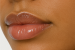 Lip Filler
