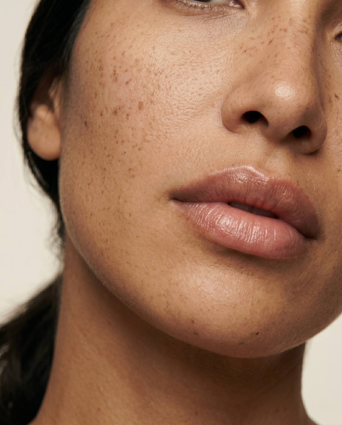 Woman posing after a lip filler treatment at HoneMD med spa