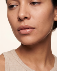 Woman posing after a lip flip treatment at HoneMD med spa