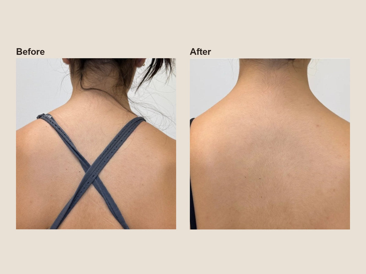 Before and after trap tox results at HoneMD