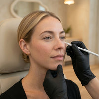 Provider marking the eye area for crow's feet treatment at HoneMD