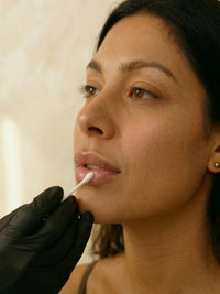 Provider injecting lip filler for a client at HoneMD