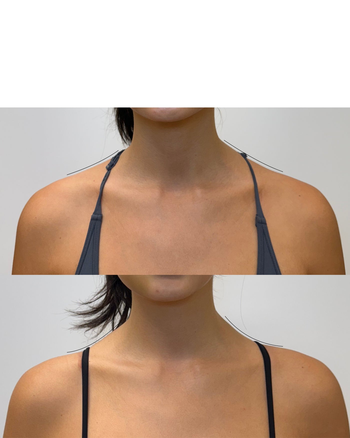 Before and after trap tox results from the front at HoneMD