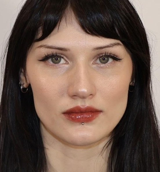 After cheek and jawline contouring